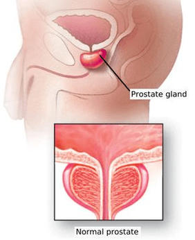 Schematic diagram of the structure of the male prostate